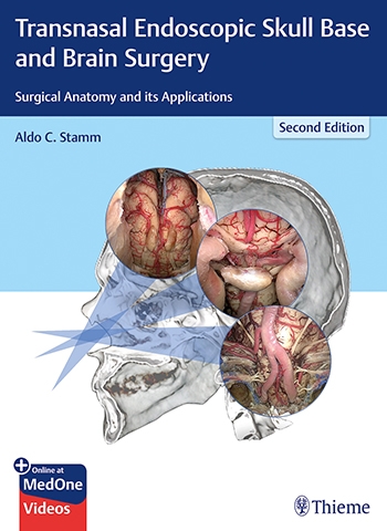 Transnasal Endoscopic Skull Base & Brain Surgery, 2nd ed