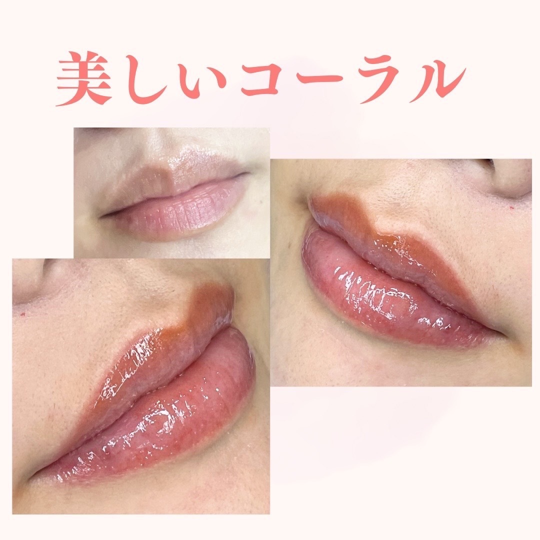 リップアートメイク | 西山歯科医院 港区南麻布