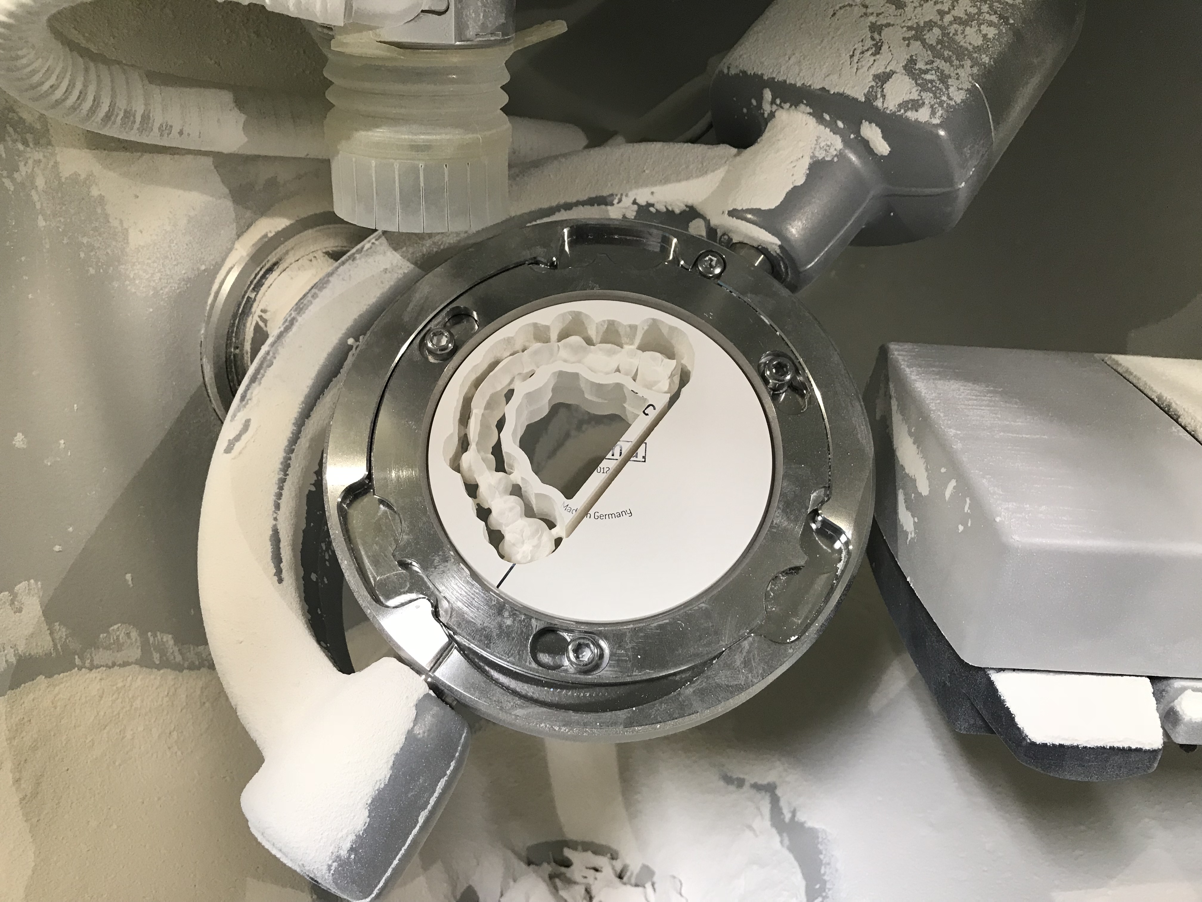 メタルボンド | オールセラミックス、CAD／CAM冠などのCAD