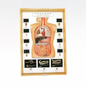 B103 人体寄生虫卵・成虫寄生状態模型 (製造販売企業:株式会社坂本