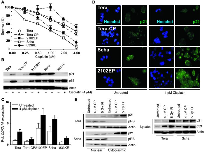 JCI - Cytoplasmic p21 expression levels determine cisplatin
