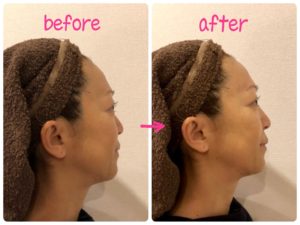 ホームケア美顔器『美ion』無料体験実施中♪ | エステティック