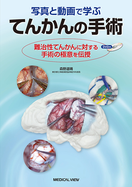 m3電子書籍 | 大脳白質解剖入門（An Introduction of Fiber Dissection