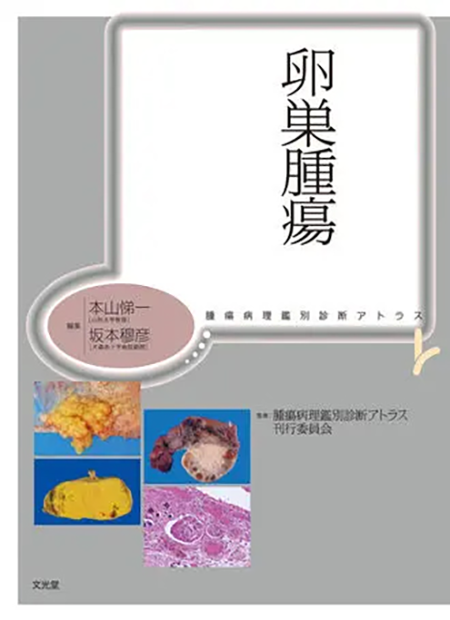 m3電子書籍 | 腫瘍病理鑑別診断アトラス 大腸癌 第2版