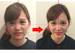 小顔スッキリ（顔の歪み、フェイスライン）｜整体／骨盤矯正なら口コミ
