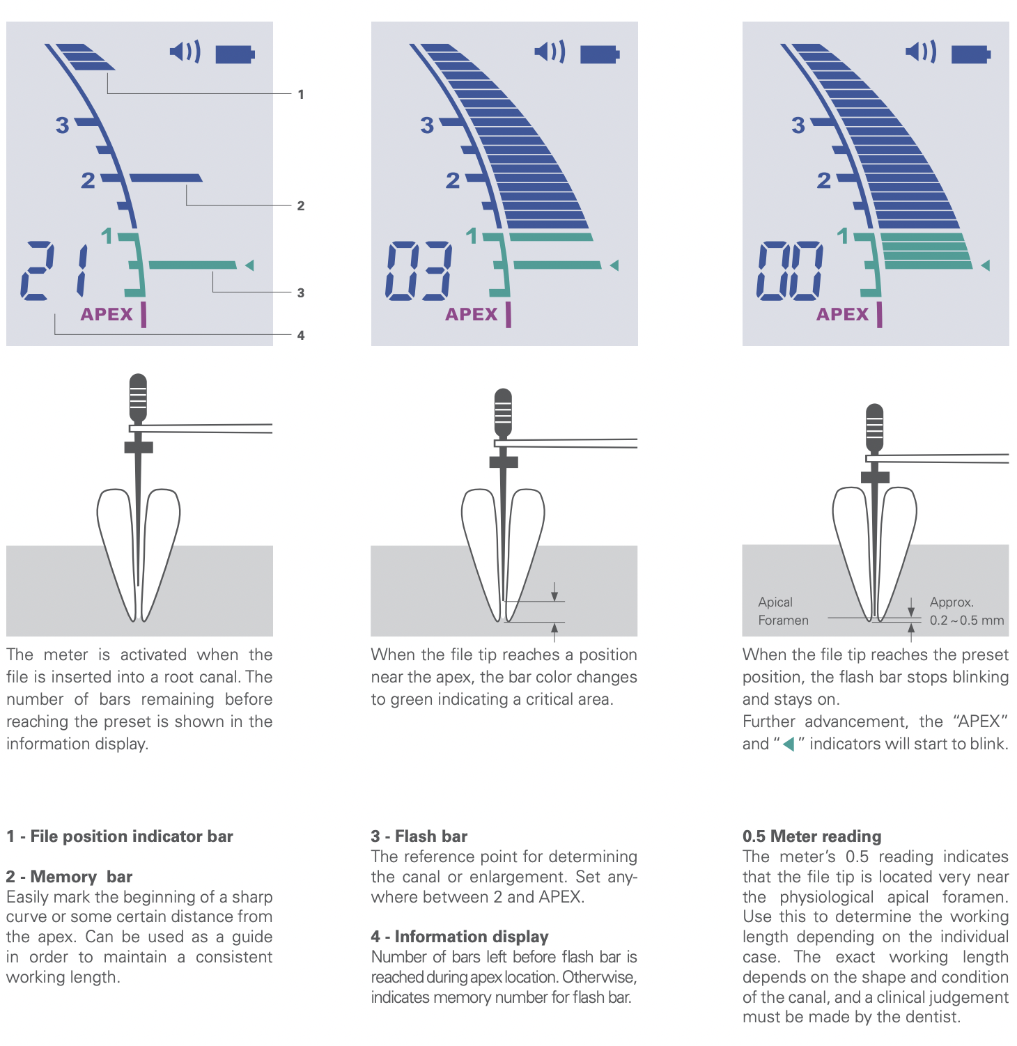 Morita Root ZX mini - Apex Locator