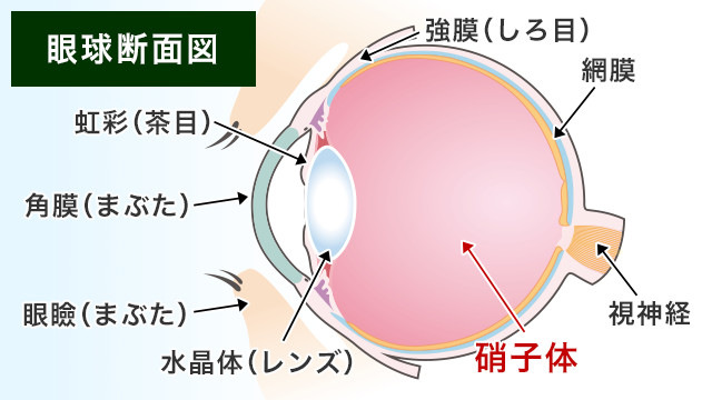 硝子体手術・日帰り手術 | 兵庫県明石市の田村眼科｜JR明石駅徒歩2分
