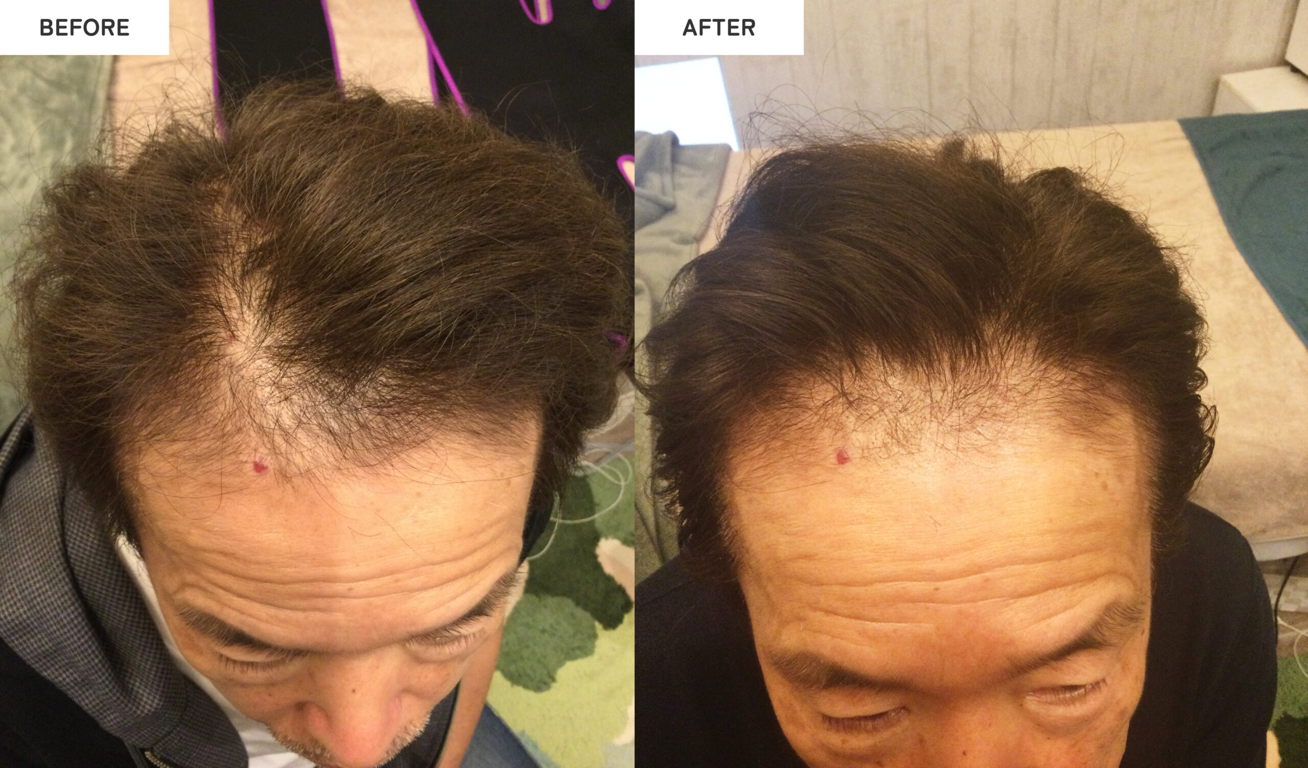 頭活 - エステサロン向け美容機器・基礎化粧品のフレキシアエステ