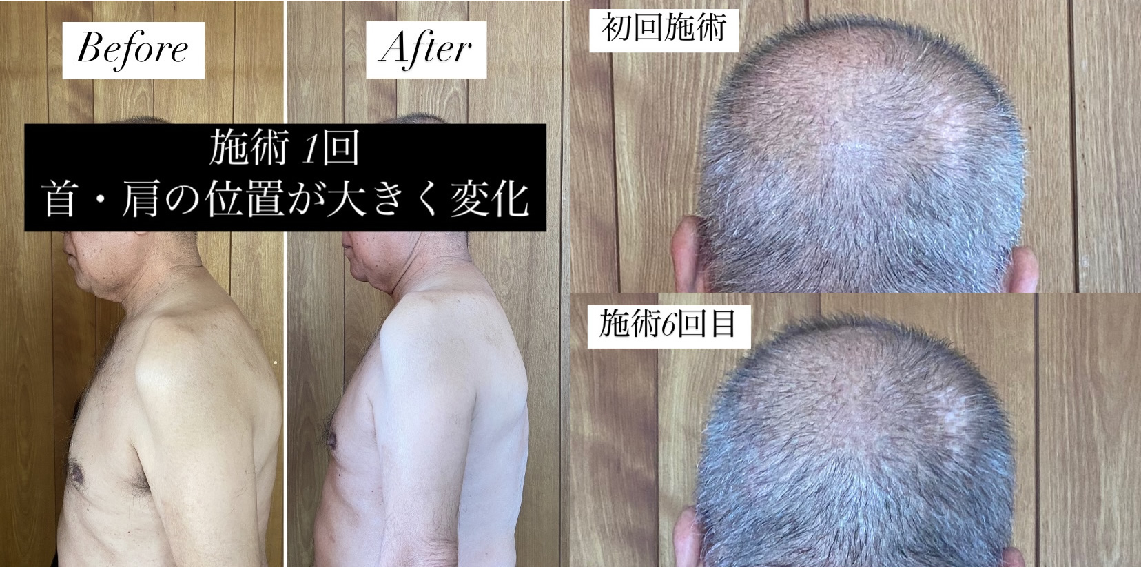 頭活 - エステサロン向け美容機器・基礎化粧品のフレキシアエステ