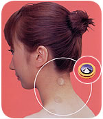 貼付型接触針 ゲルマ・イオネットのご紹介