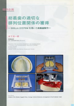 歯科技工 | セラミックスの福重歯研