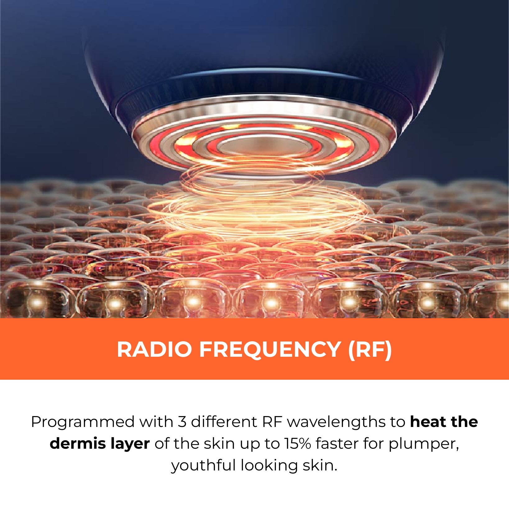 Bloom WR STAR – GLOBAL YA-MAN