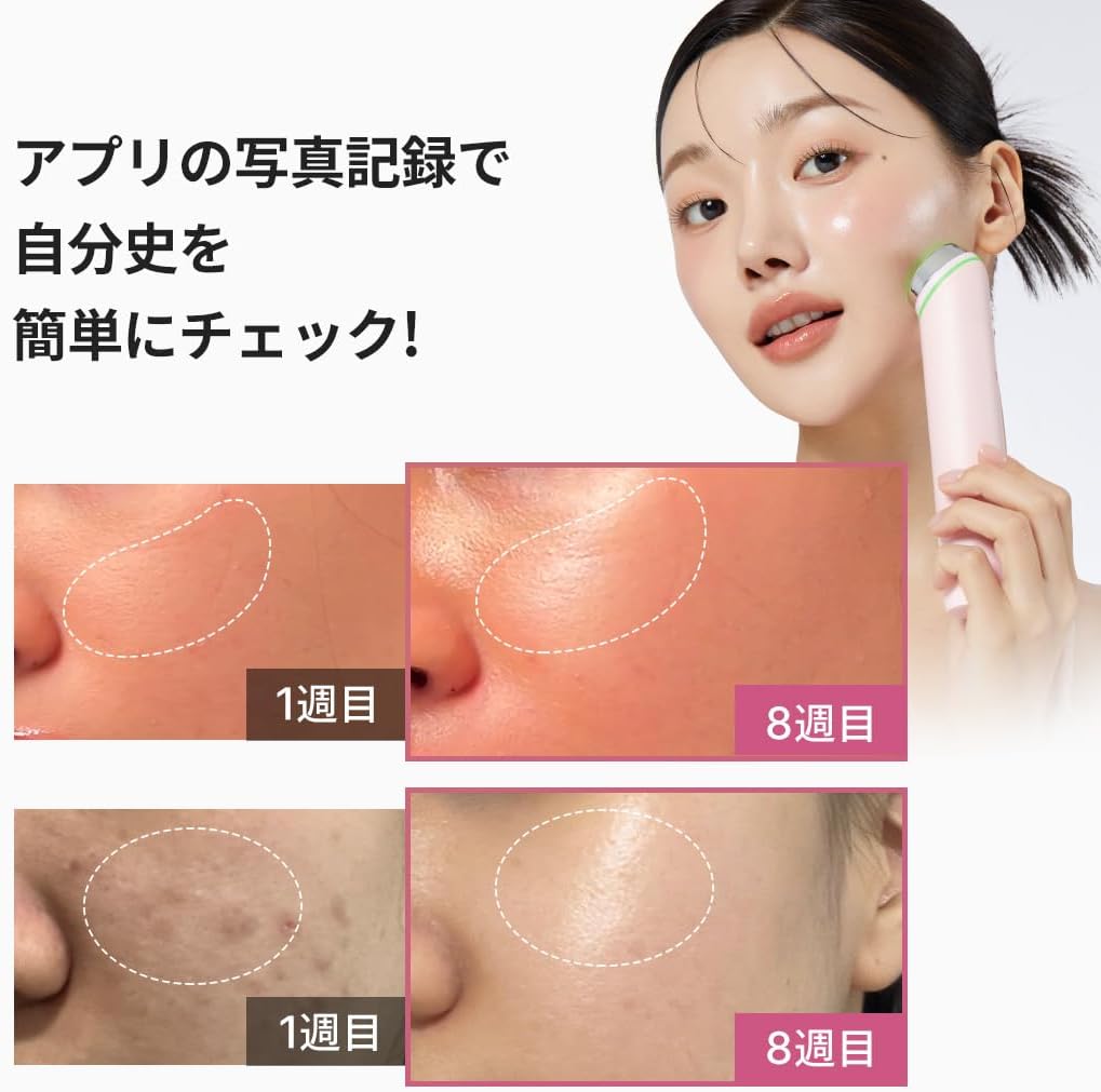 月額4,980円レンタルプラン：メディキューブ AGE-Rブースタープロ 美顔