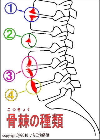 腰椎の生体力学 【鍼灸師が執筆・監修】