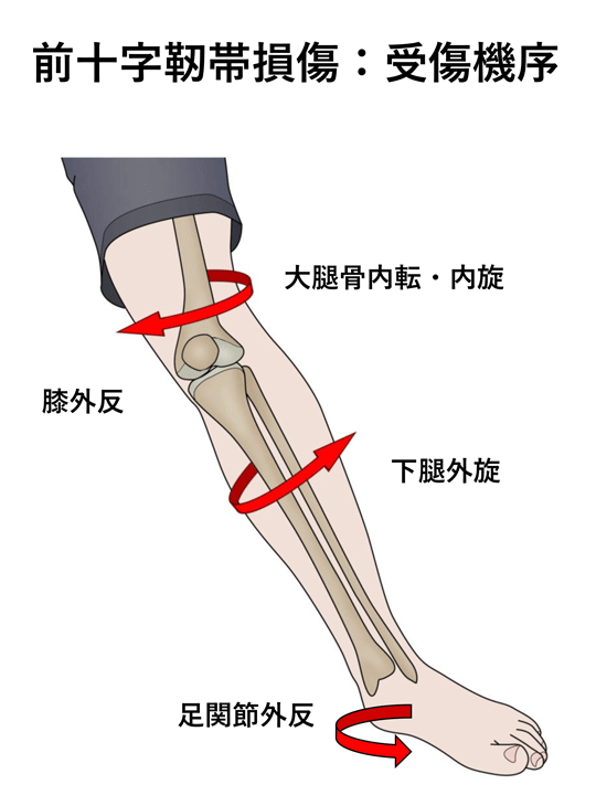 スポーツ外傷／障害｜はっとり整形外科・リウマチ科クリニック