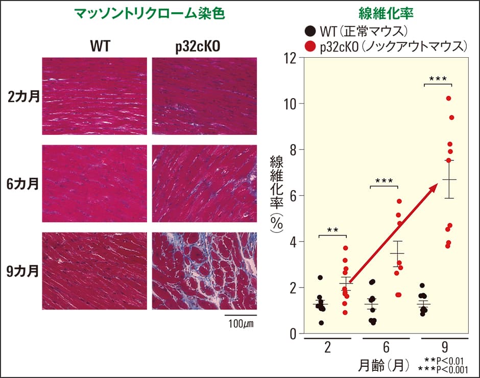 老化による機能低下を遅らせ「健康寿命」の延伸を目指す