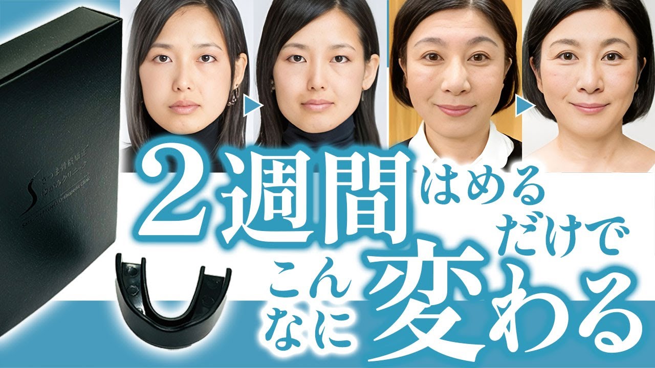 さつま式小顔矯正マウスピースの紹介 #美容整体 #小顔矯正 #歪み改善
