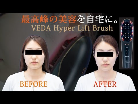 自宅で本格リフトアップ！YAMANのブラシ型美顔器ヴェーダハイパー