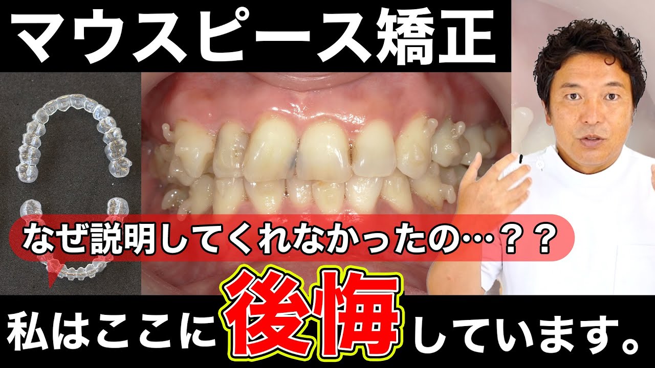 Actually [Points I regret about using mouthpiece orthodontics