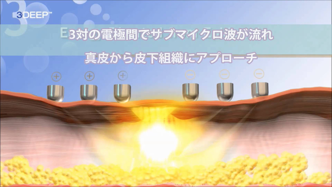 newaリフト］ ひきしめの秘密 3DEEPテクノロジー - YouTube