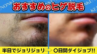 ヒゲ脱毛】ケノンのストロングカートリッジを3カ月やった結果 - YouTube