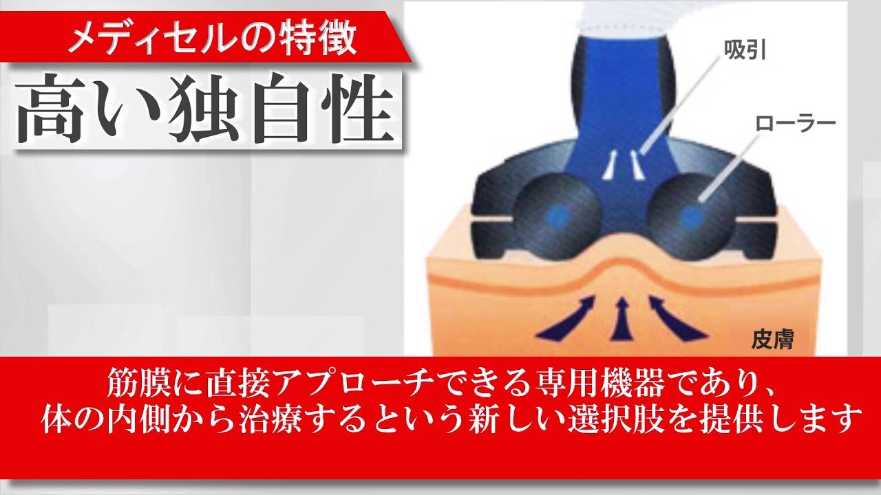 筋膜吸引装置 メディセル ミニ | 医療機器 医薬品なら日健医療器株式会社