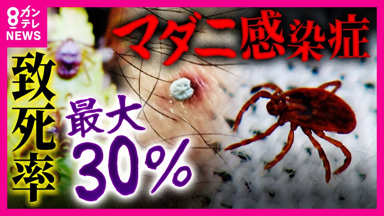致死率最大30％
