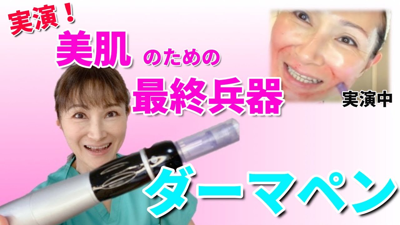 自宅でセルフダーマペン。ノーカット徹底解説！ - YouTube