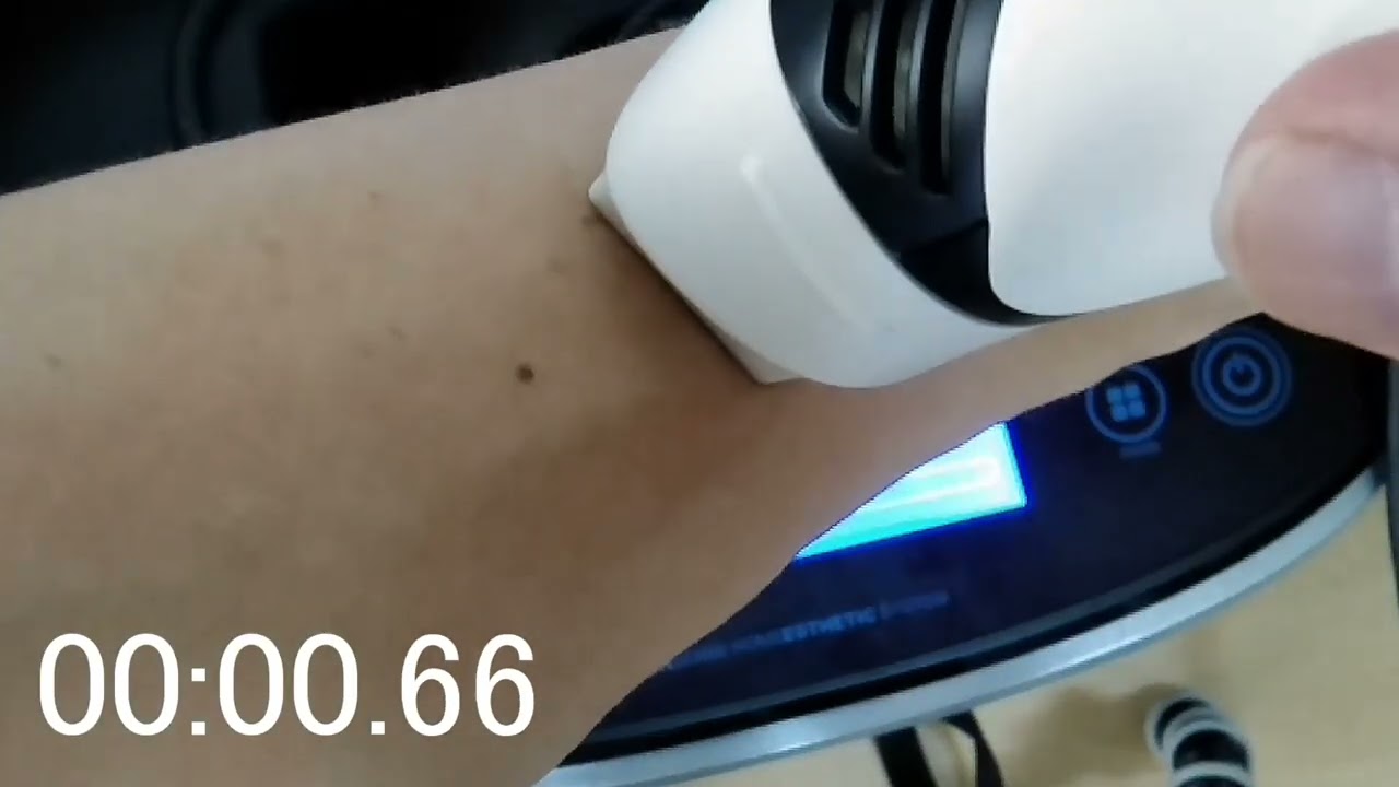 ケノンのバージョン、新旧の主な違いまとめ | 自分で脱毛ドットコム