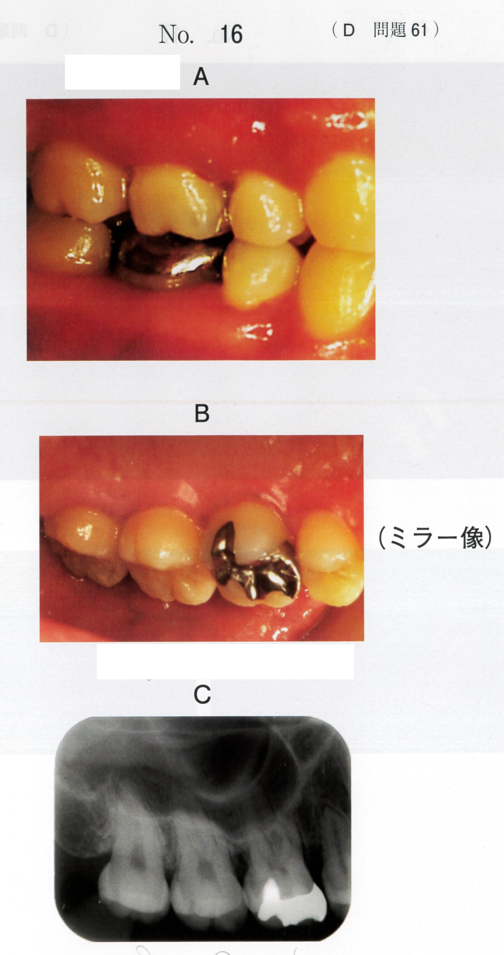第119回 歯科医師国家試験 D問題 （2026年2月6日更新） | DENTAL YOUTH