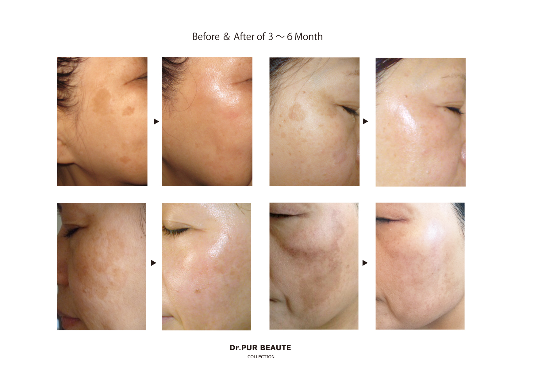 Dr.PUR BEAUT | 【肥後橋駅徒歩3分】温活リラクゼーションサロンRattan