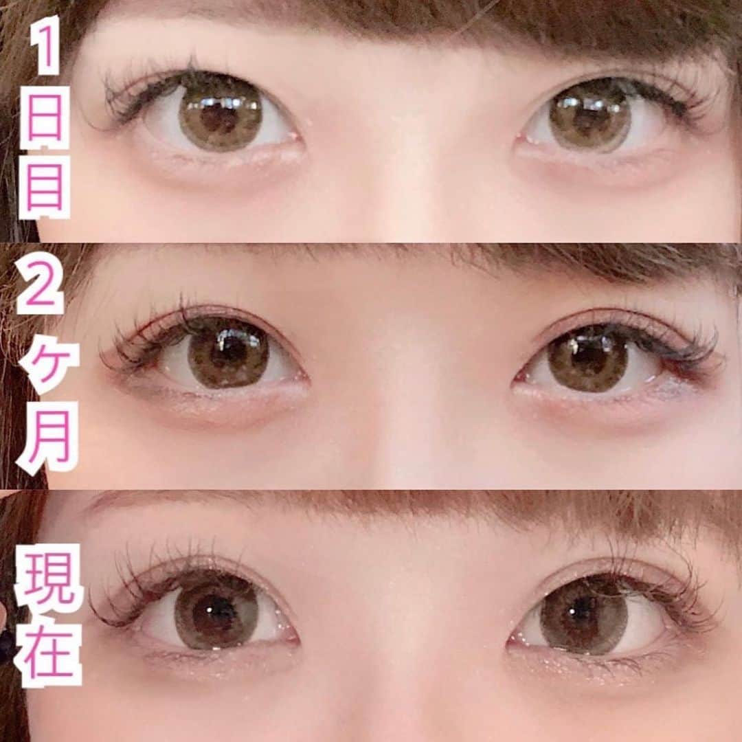 ナイトアイボーテ ナイトアイボーテ 3個セット NEWナイトアイボーテ3