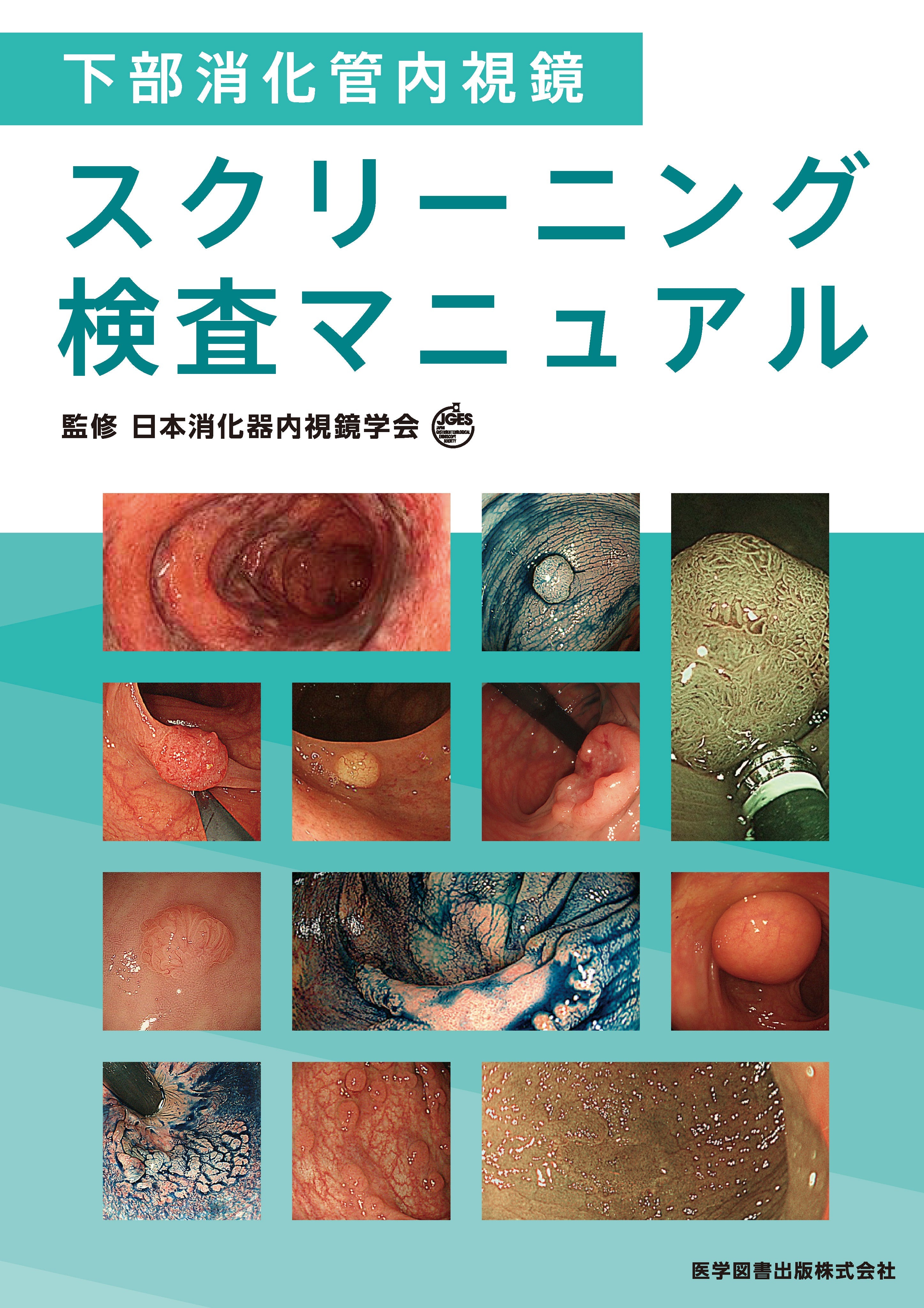下部消化管内視鏡スクリーニング検査マニュアル – 医学図書出版