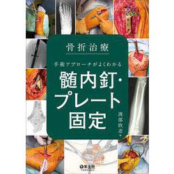 ヨドバシ.com - 骨折治療 手術アプローチがよくわかる髄内釘・プレート