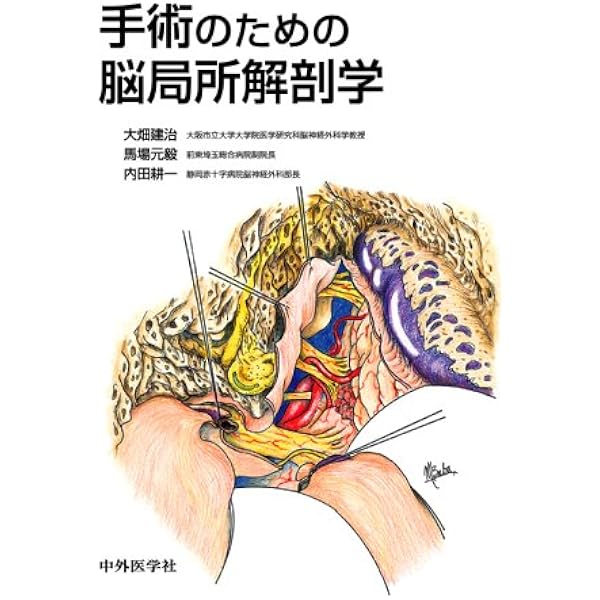 脳・脊髄血管造影マニュアル | 宮坂 和男 |本 | 通販 | Amazon