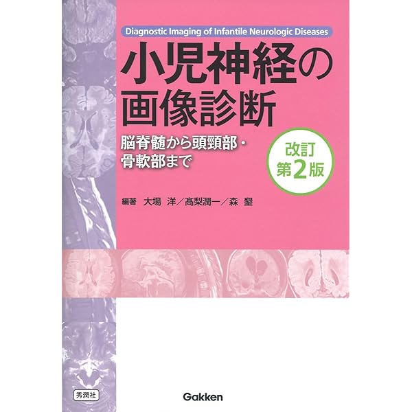 エキスパートが鑑別する 小児の画像診断: 300症例でみる読み方と考え方