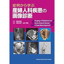 61CXEtAJc-L._AC_UL210_SR210,