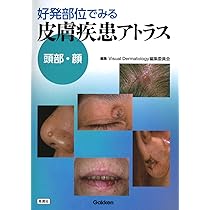 61XFB9b0XVL._AC_UL210_SR210,