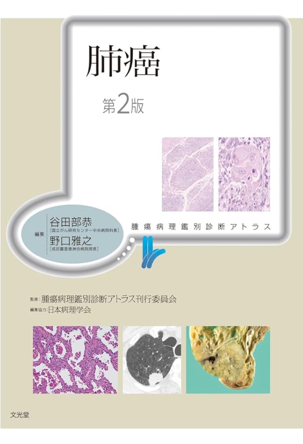 肺 (非腫瘍性疾患病理アトラス) | 蛇澤 晶, 熊坂利夫 |本 | 通販 | Amazon