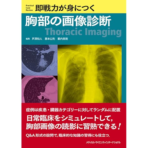 小児神経の画像診断 改訂第2版: ―脳脊髄から頭頸部・骨軟部まで