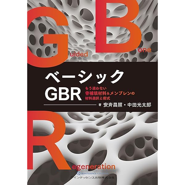 Amazon.co.jp: インプラント図鑑: 視覚で巡るインプラントの世界
