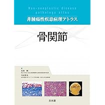 Amazon.co.jp: 皮膚軟部腫瘍アトラス 改訂第2版 : 安齋 眞一, 廣瀬
