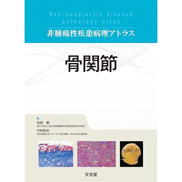 リンパ組織 (非腫瘍性疾患病理アトラス) | 佐藤康晴, 竹内賢吾 |本
