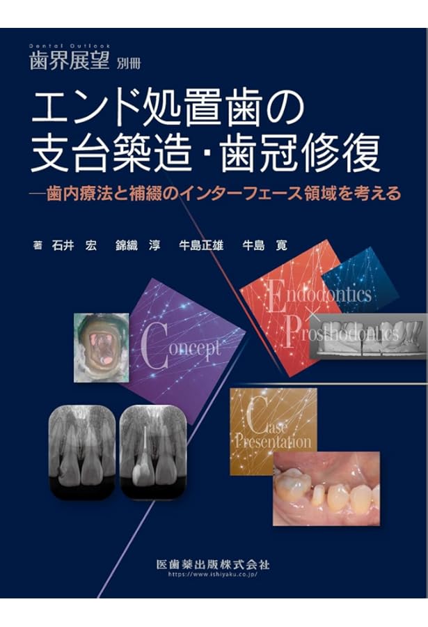 Amazon.co.jp: 5-Dコンセンサス 歯の保存にこだわる: これまでの軌跡と