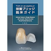 ザ・プロビジョナルレストレーションズII: 補綴治療の長期的成功を得る