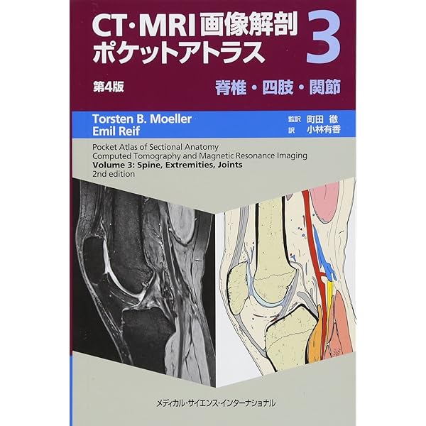 関節のMRI 第3版 | 上谷雅孝, 青木隆敏, 神島 保, 江原 茂, 杉本英治