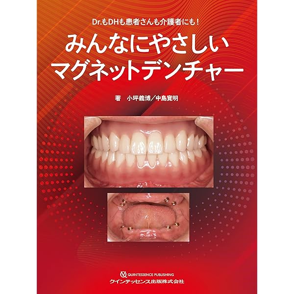 Amazon.co.jp: GDS 総義歯の真髄 : 松本 勝利: Japanese Books