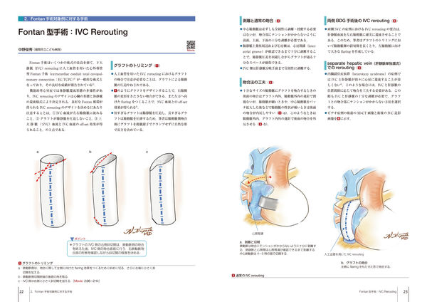 先天性心疾患の手術 坂本喜三郎(編) - 中山書店 | 版元ドットコム