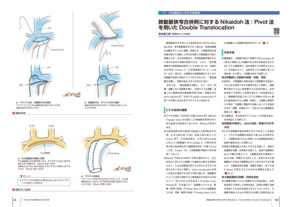 先天性心疾患の手術 坂本喜三郎(編) - 中山書店 | 版元ドットコム