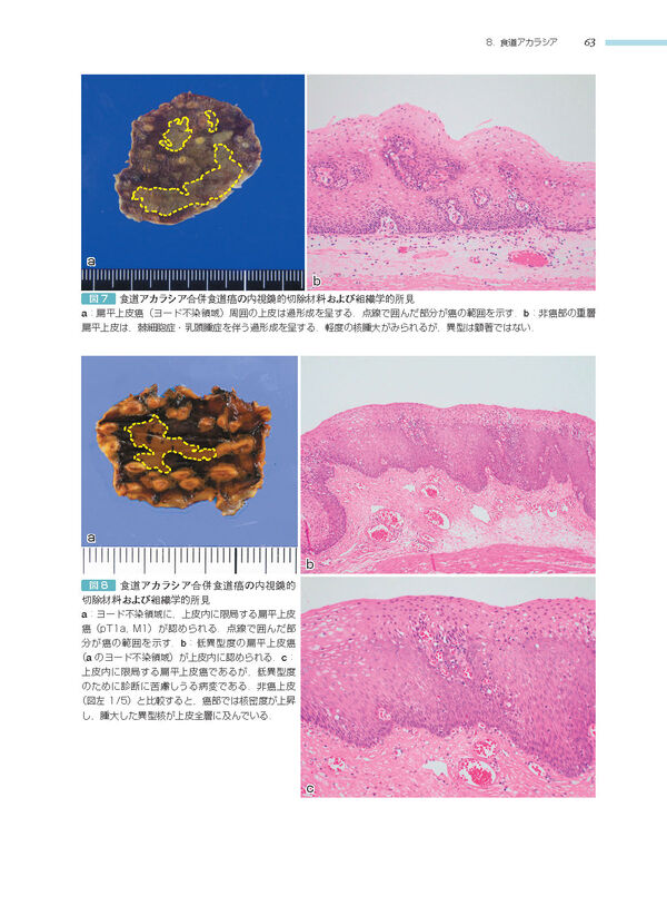 消化管 (非腫瘍性疾患病理アトラス) 九嶋 亮治(編) - 文光堂 | 版元
